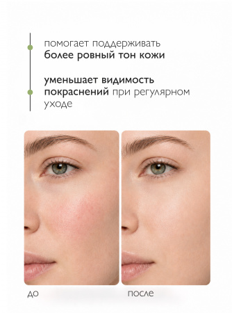 SIBIRBOTANIQ НАТУРАЛЬНЫЙ КРЕМ ДЛЯ ЛИЦА ANTI COUPEROSE С ПЕПТИДАМИ (АНТИ КУПЕРОЗ), 50 ml