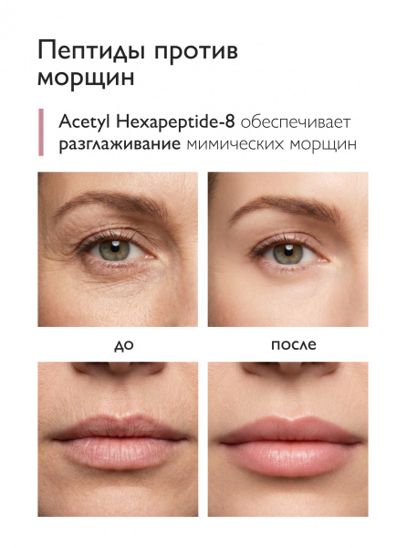 SIBIRBOTANIQ МУЛЬТИПЕПТИДНАЯ СЫВОРОТКА ДЛЯ ОБЛАСТИ ВОКРУГ ГЛАЗ И ГУБ АНТИВОЗРАСТНАЯ ANTI AGE, 10 ml