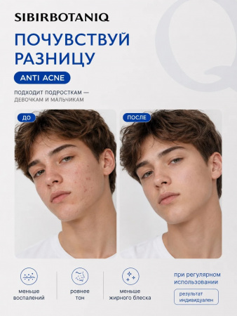 НАТУРАЛЬНЫЙ КРЕМ ОТ ПРЫЩЕЙ  ДЛЯ ПРОБЛЕМНОЙ КОЖИ ЛИЦА, 50 ml